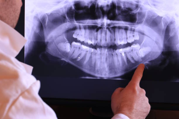 Best Emergency Dentist for Knocked-Out Tooth in Olivet, NJ