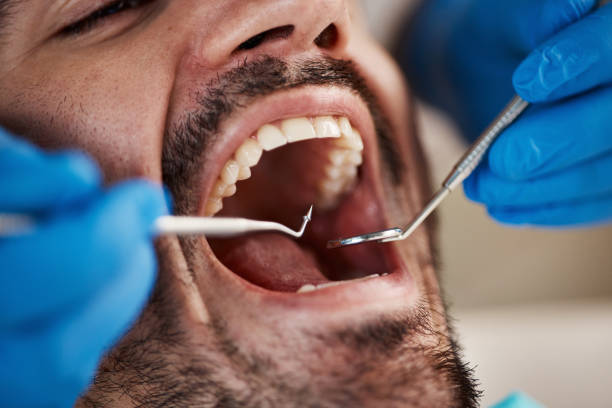Best Urgent Dental Care for Toothache in Olivet, NJ